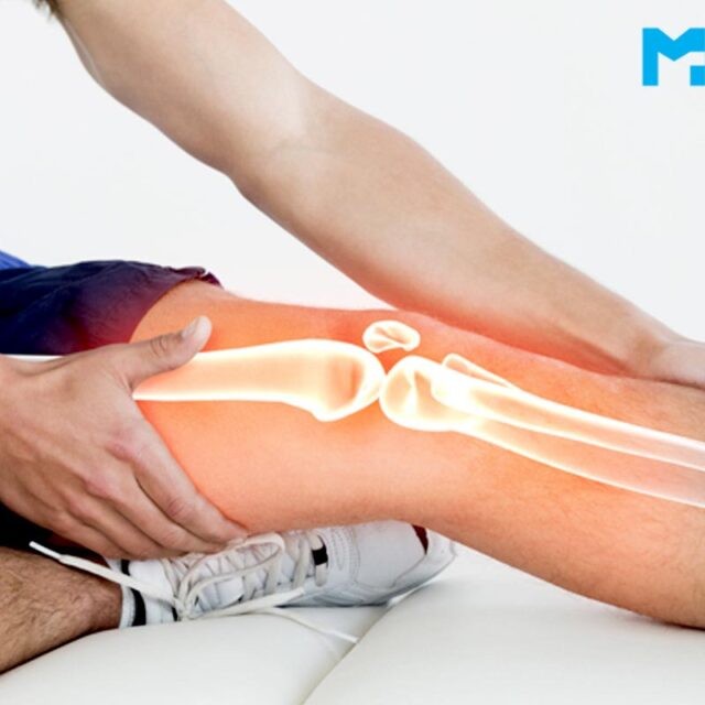 All You Want to Know About Total Knee Replacement