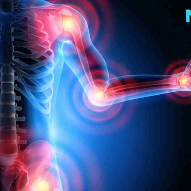 What Is Osteoarthritis? Stages, Symptoms, Causes, Diagnosis, And Treatment